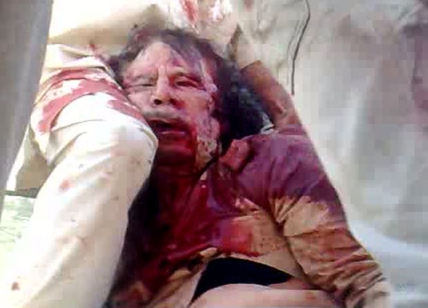 111020022514-gadhafi-wounded-graphic-do-not-use-on-stories-without-approval-2